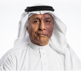 Suliman Algwaiz